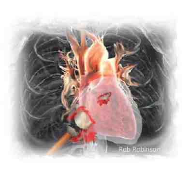 Jesus Pierced For Us