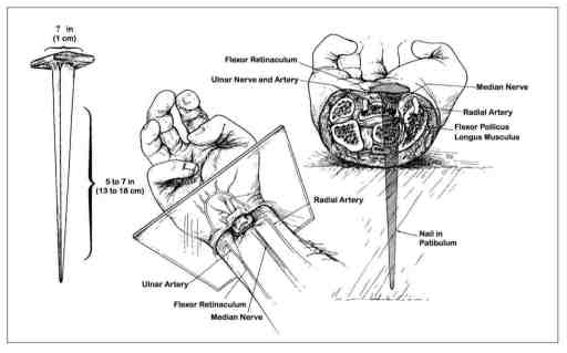 nail through wrist sm